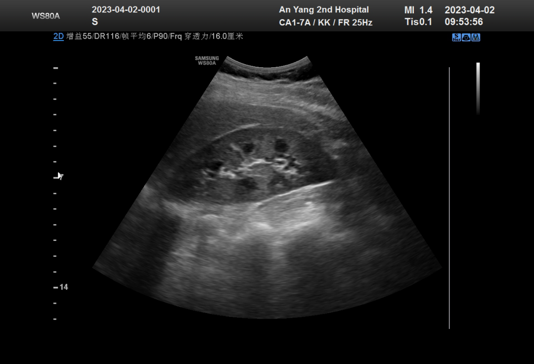 1681872381849930.png 640.png